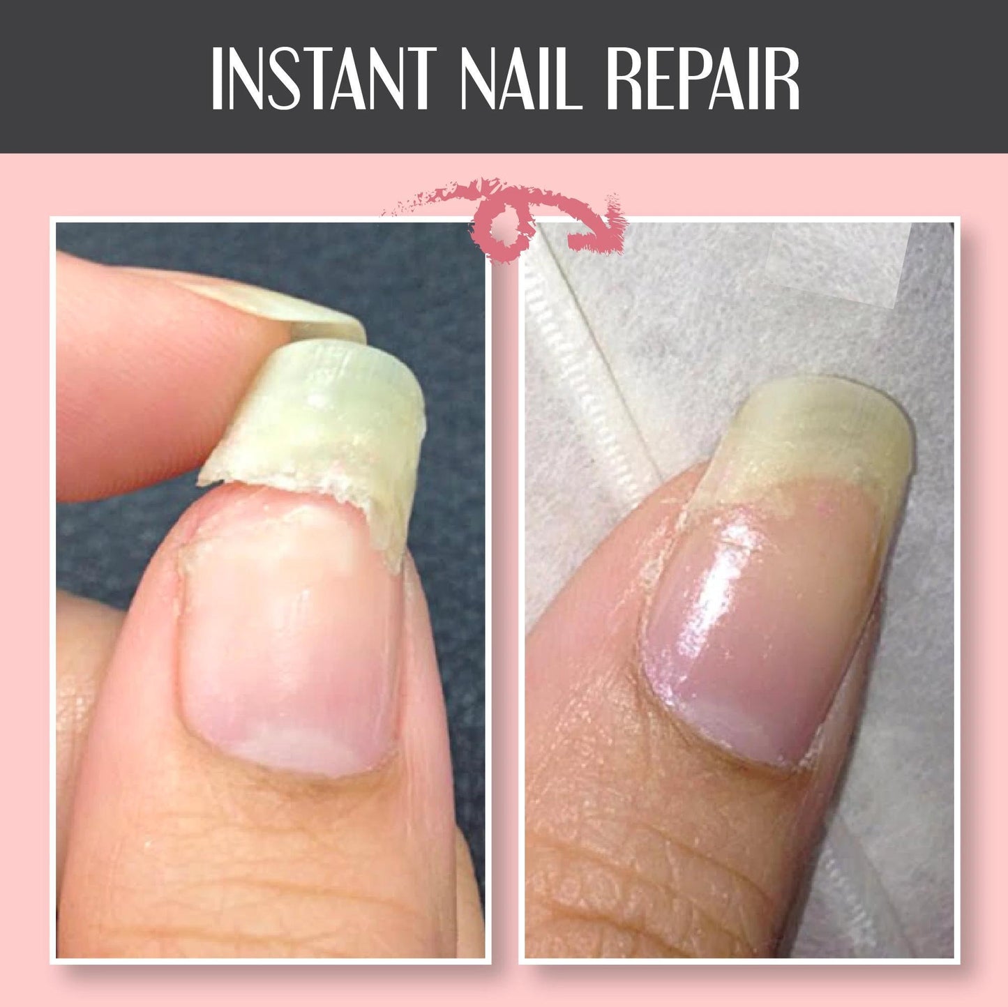 Magic Nail Care Gel™ | Reinforced and protected nails