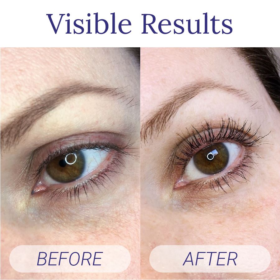 Wimper Versterking Serum | 1+1 GRATIS