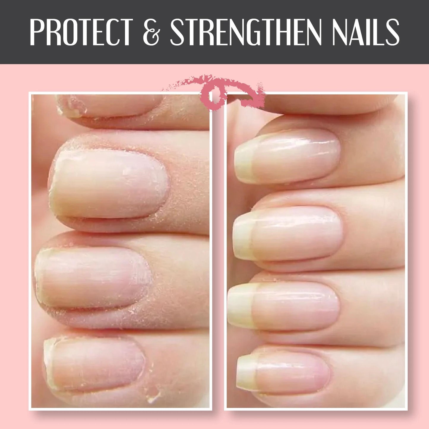 Magic Nail Care Gel™ | Reinforced and protected nails