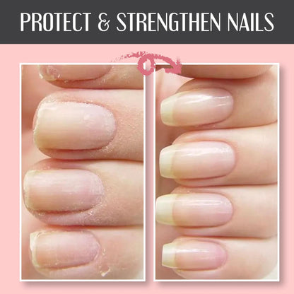 Magic Nail Care Gel™ | Reinforced and protected nails